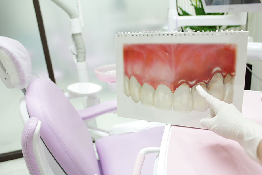 歯周病予防・治療